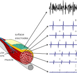 Electromyography recruitment lesson motor unit