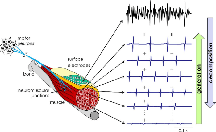 Electromyography recruitment lesson motor unit